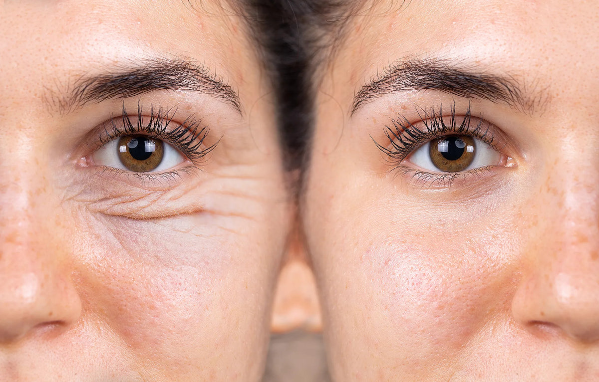 1+1 GRATIS Antiagepro™- El primer lápiz de colágeno con tecnología lifting que eliminan los surcos de la boca en 10 min , olvidate de los trataientos agresivos y quimicos
