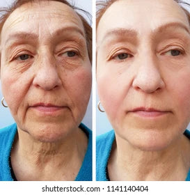 1+1 GRATIS Antiagepro™- El primer lápiz de colágeno con tecnología lifting que eliminan los surcos de la boca en 10 min , olvidate de los trataientos agresivos y quimicos