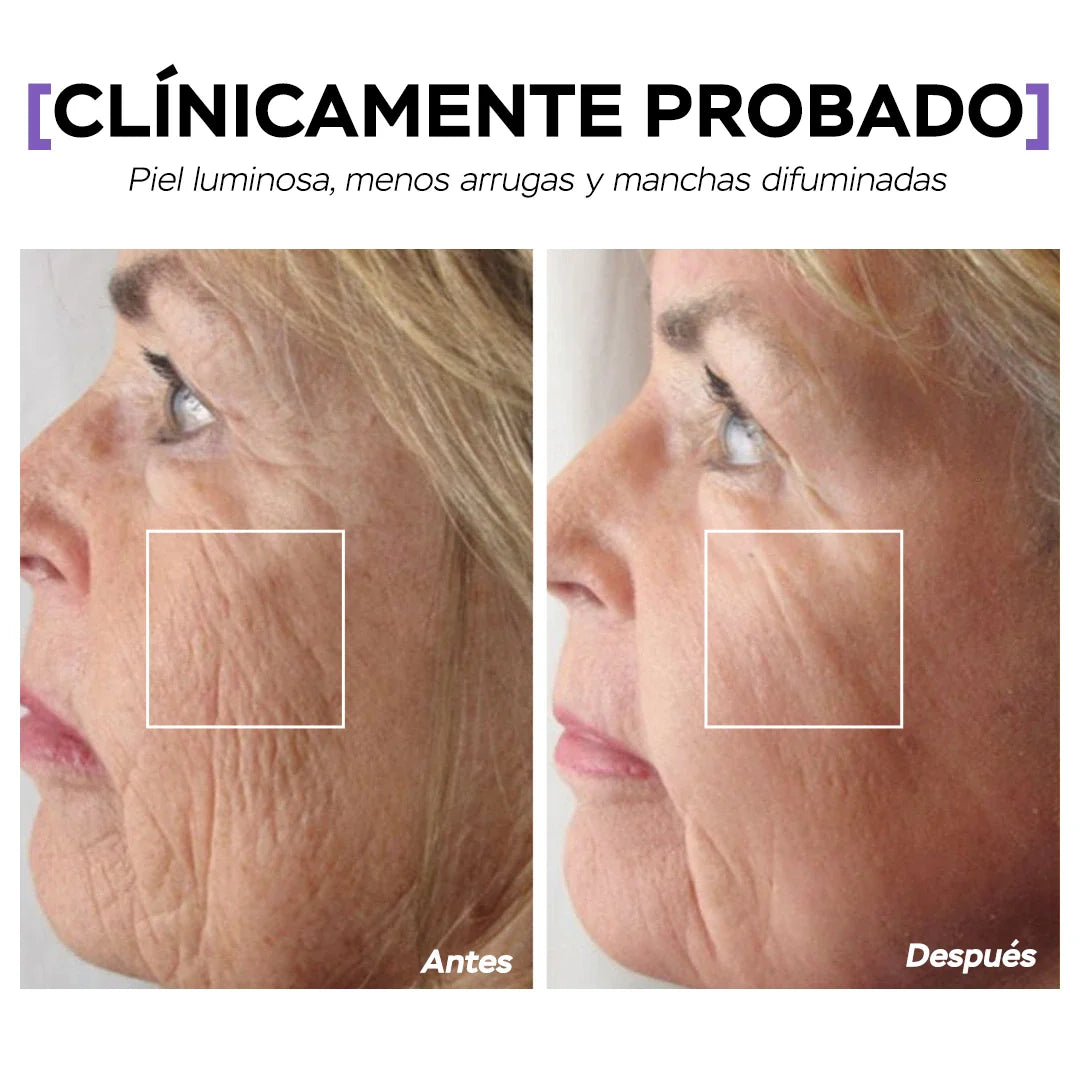 1+1 GRATIS Antiagepro™- El primer lápiz de colágeno con tecnología lifting que eliminan los surcos de la boca en 10 min , olvidate de los trataientos agresivos y quimicos