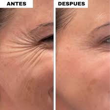 1+1 GRATIS Antiagepro™- El primer lápiz de colágeno con tecnología lifting que eliminan los surcos de la boca en 10 min , olvidate de los trataientos agresivos y quimicos