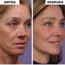 1+1 GRATIS Antiagepro™- El primer lápiz de colágeno con tecnología lifting que eliminan los surcos de la boca en 10 min , olvidate de los trataientos agresivos y quimicos